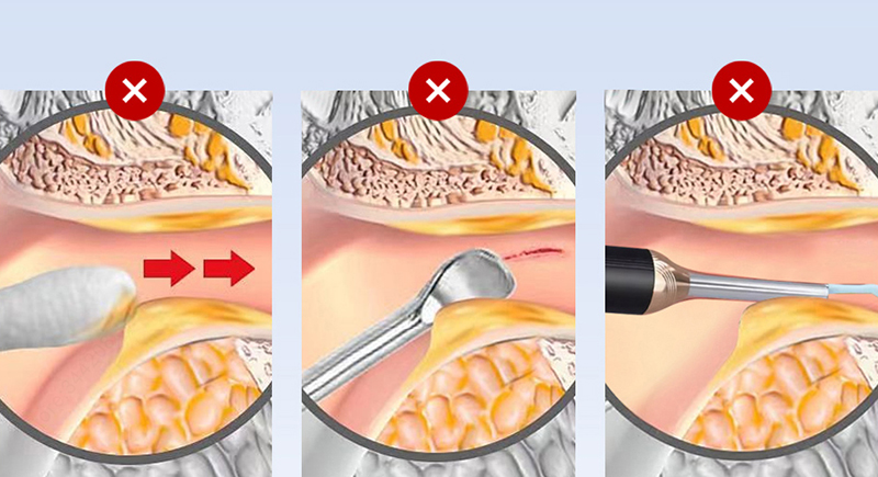 Xiaomi Youpin DOCO Electric Ear Cleaner Wash Device EC001 6972169001676 Фото №3